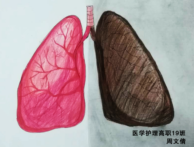 卫生健康学院举办世界无烟日吸烟前后肺部解剖对比图绘画比赛