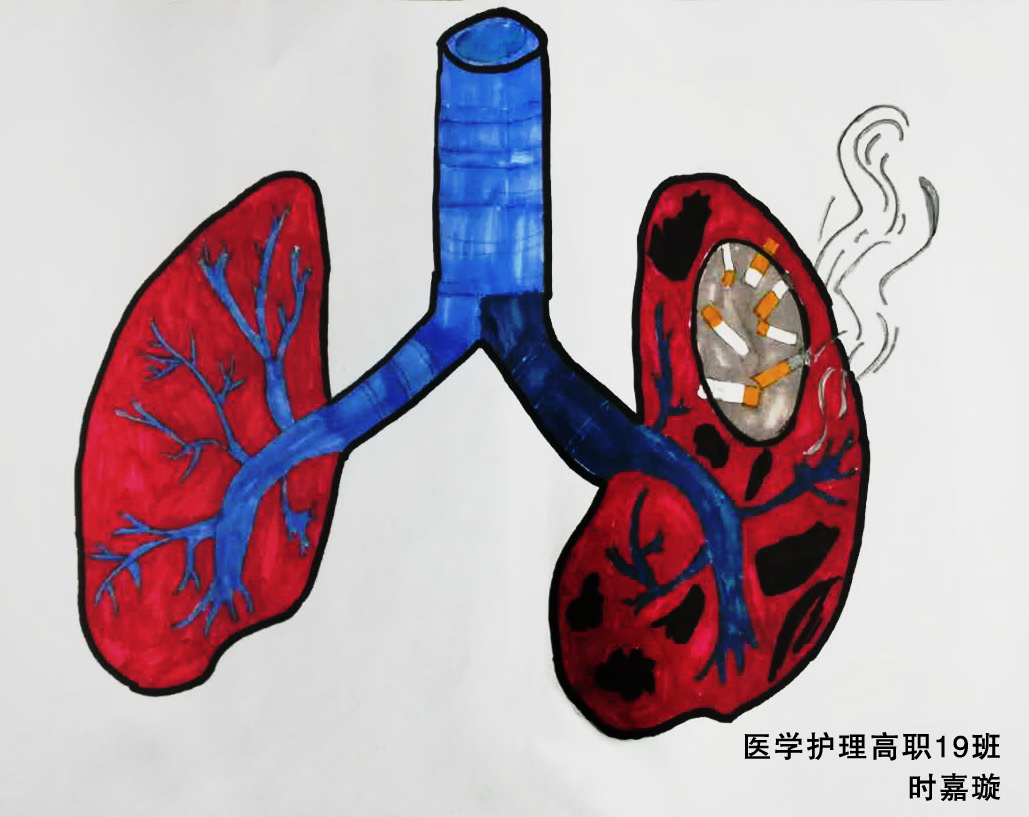 卫生健康学院举办世界无烟日吸烟前后肺部解剖对比图绘画比赛